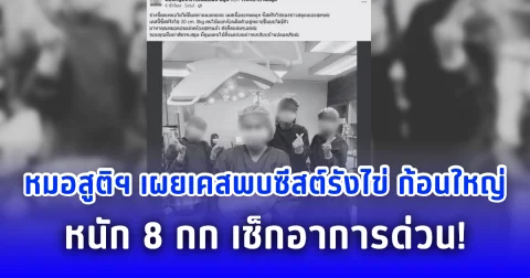 หมอสูติฯ เผยเคสพบซีสต์รังไข่ ก้อนใหญ่ หนัก 8 กก. เช็กอาการด่วน!