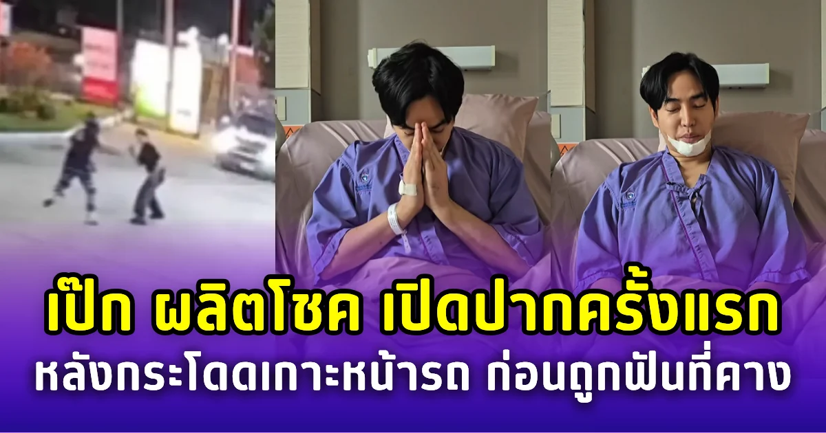 เป๊ก ผลิตโชค เปิดปากครั้งแรก หลังกระโดดเกาะหน้ารถ ก่อนถูกฟันที่คางจนบาดเจ็บ