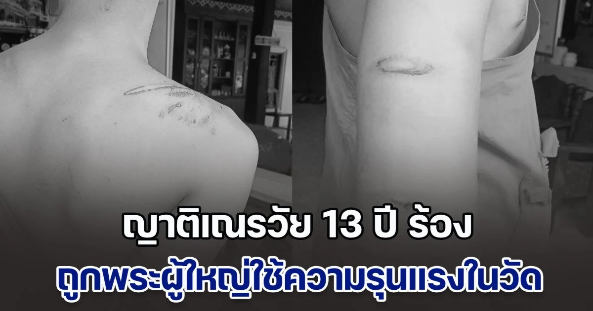ญาติเณรวัย 13 ปี ร้องขอความเป็นธรรม ถูกพระผู้ใหญ่ใช้ความรุนแรงในวัด