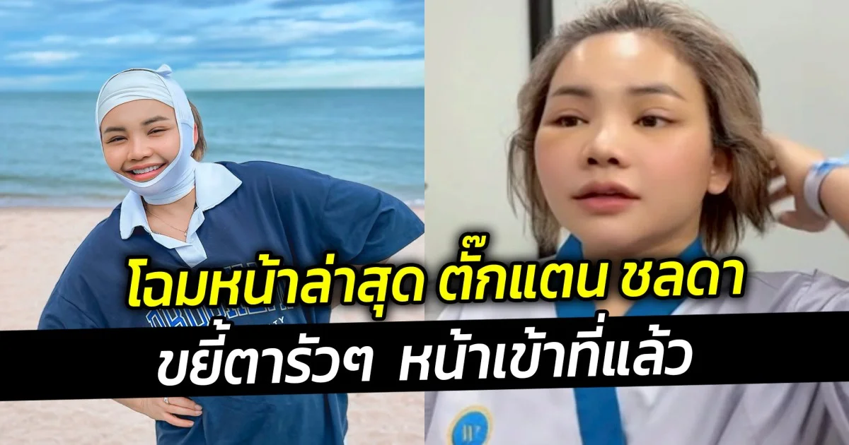 โฉมหน้าล่าสุด ตั๊กแตน ชลดา ขยี้ตารัวๆ  หน้าเข้าที่แล้ว