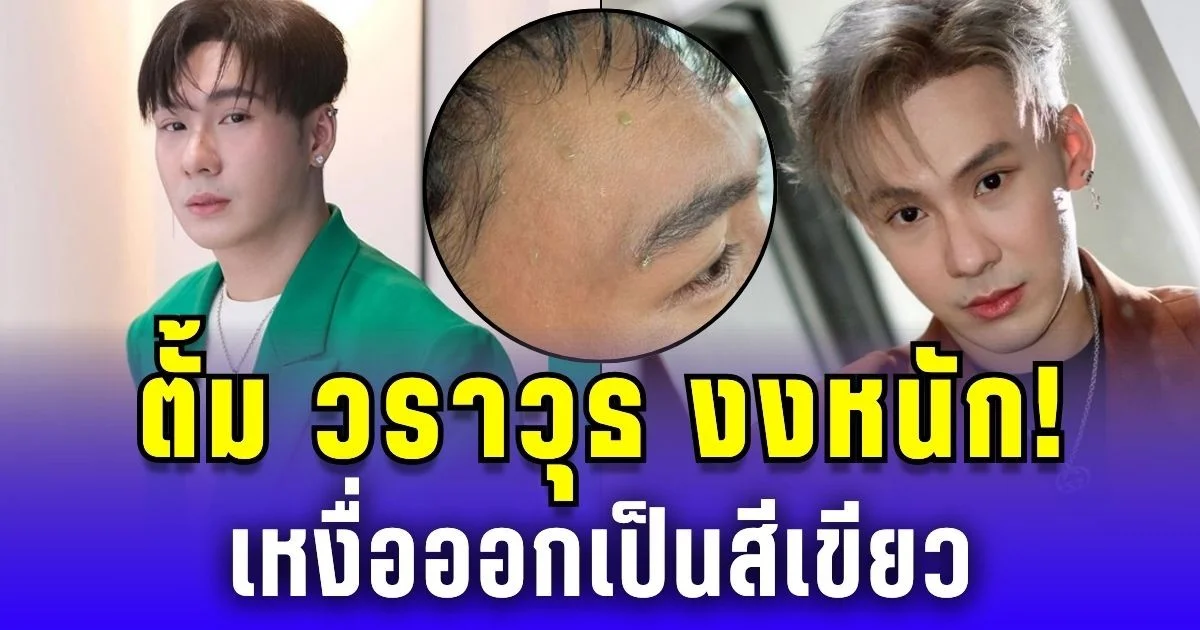 ตั้ม วราวุธ งงหนัก! เหงื่อเขียว โซเชียลแห่สงสัย ก่อนหมอตอบชัด