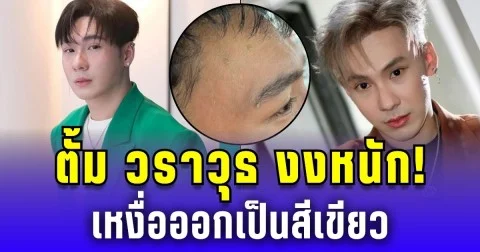ตั้ม วราวุธ งงหนัก! เหงื่อเขียว โซเชียลแห่สงสัย ก่อนหมอตอบชัด