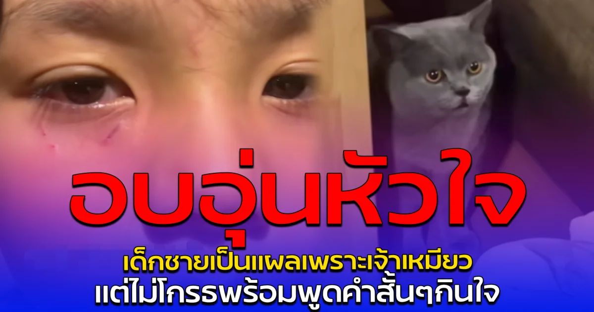 อบอุ่นหัวใจ เด็กชายเป็นแผลเพราะเจ้าเหมียว แต่ไม่โกรธพร้อมพูดคำสั้นๆกินใจ