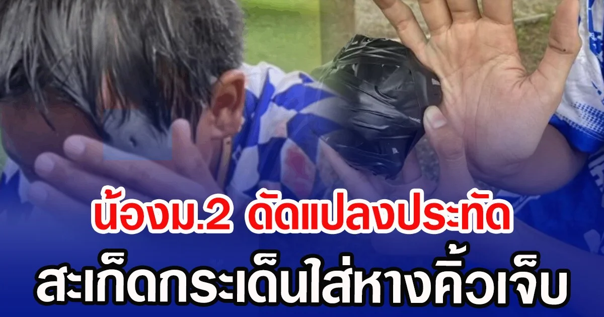 น้องม.2 ดัดแปลงประทัด สะเก็ดกระเด็นใส่หางคิ้วเจ็บ