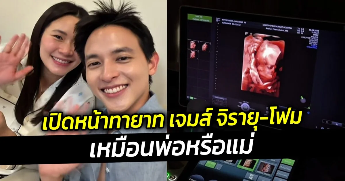 เปิดหน้าทายาท เจมส์ จิรายุ-โฟม เหมือนพ่อหรือแม่