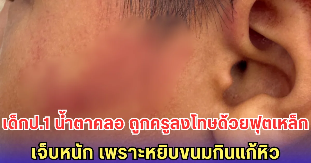 เด็กป.1 น้ำตาคลอ ถูกครูลงโทษด้วยฟุตเหล็ก เจ็บหนัก เพราะหยิบขนมกินแก้หิว