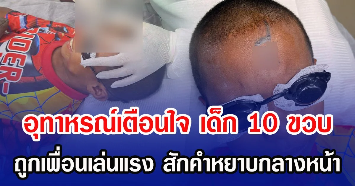 อุทาหรณ์เตือนใจ เด็ก 10 ขวบ ถูกเพื่อนเล่นแรง สักคำหยาบกลางหน้า