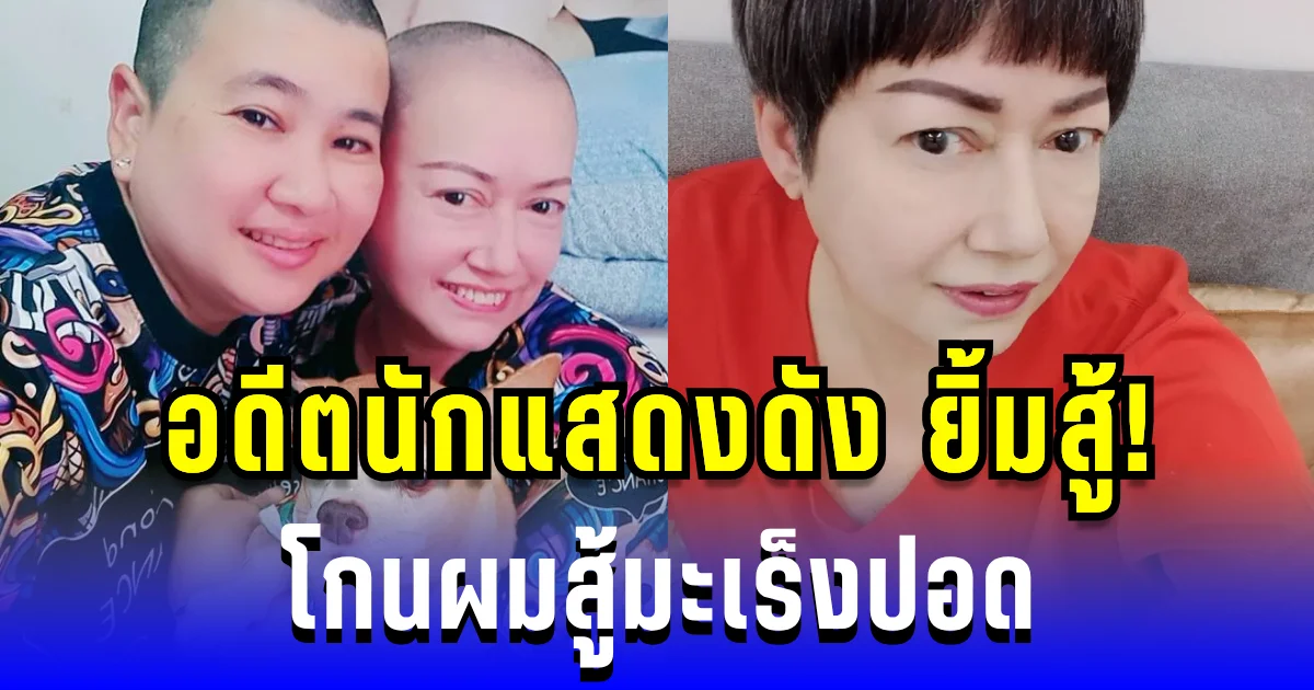 อดีตนักแสดงดัง ยิ้มสู้! โกนผมสู้มะเร็งปอด แฟนคลับแห่ส่งกำลังใจเพียบ