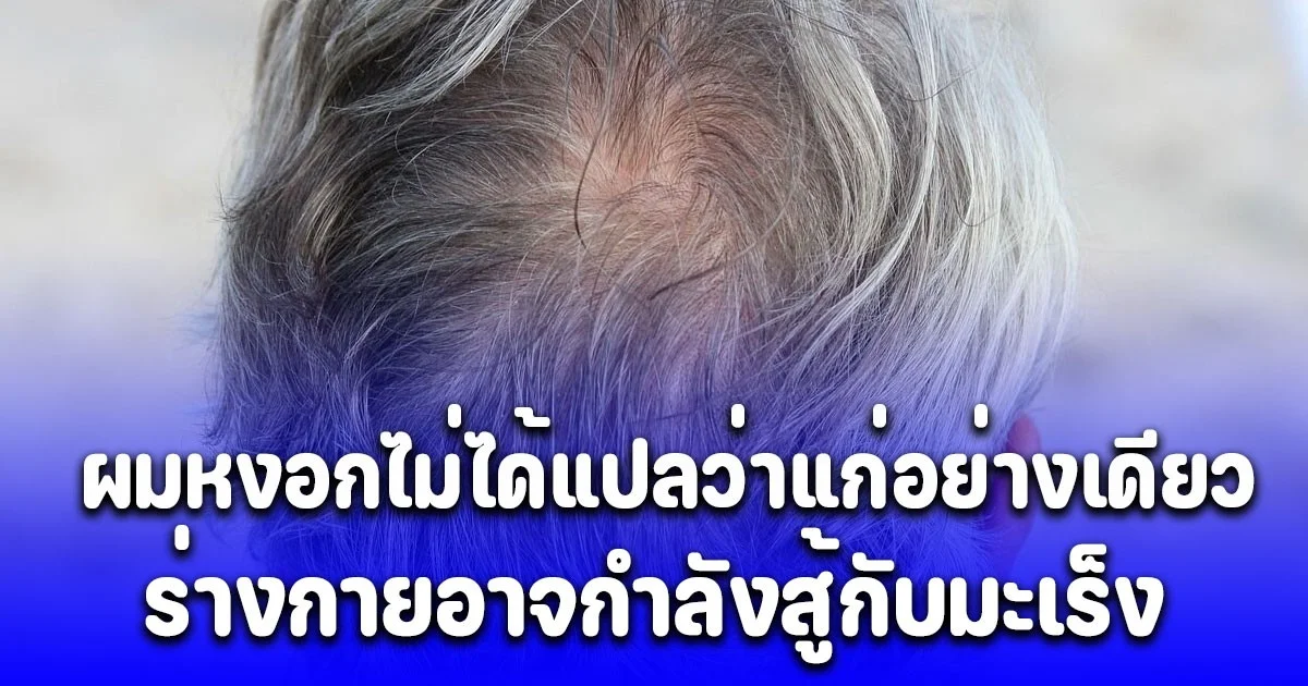 งานวิจัยล่าสุด ผมหงอกไม่ได้แปลว่าแก่อย่างเดียว แต่อาจเป็นเพราะร่างกายกำลังสู้กับมะเร็ง