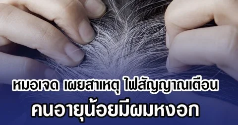 หมอเจด เผยสาเหตุ ไฟสัญญาณเตือน คนอายุน้อยมีผมหงอก