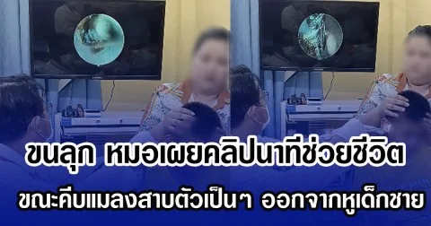 ขนลุก หมอเผยคลิปนาทีช่วยชีวิต ขณะคีบแมลงสาบตัวเป็นๆ ออกจากหูเด็กชาย (ข่าวต่างประเทศ)