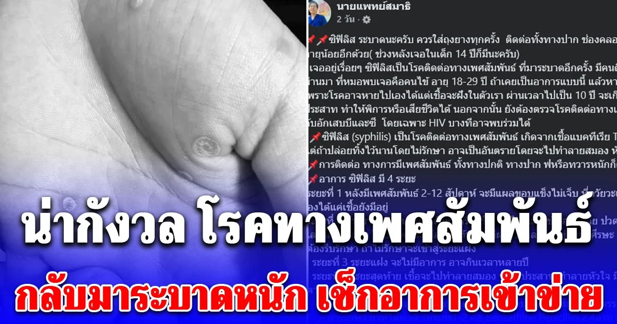 น่ากังวล โรคซิฟิลิส กลับมาระบาดหนัก ควรใส่ถุงยาง เช็กอาการเข้าข่าย
