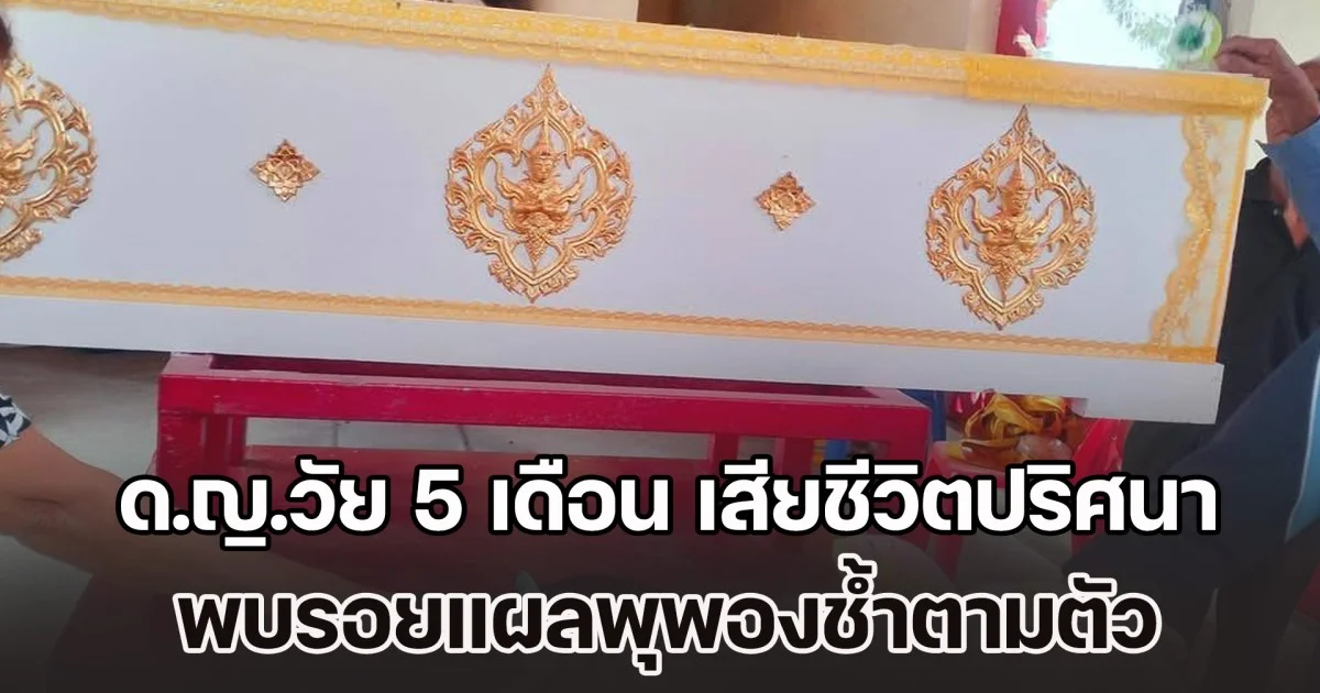 ด.ญ.วัย 5 เดือน เสียชีวิตปริศนา พบรอยแผลพุพองช้ำตามตัว ตรวจฉี่พ่อแม่เด็ก พบม่วงทั้งคู่ ผู้เป็นพ่อยันไม่ได้ทำร้ายลูก