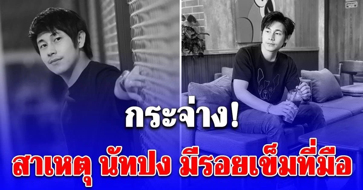 รู้แล้ว! สาเหตุ นัทปง มีรอยเข็มที่มือ