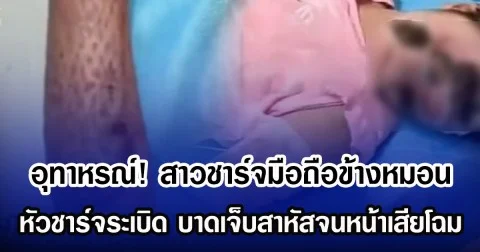 อุทาหรณ์! สาวชาร์จมือถือข้างหมอน หัวชาร์จระเบิด บาดเจ็บสาหัสจนหน้าเสียโฉม (ข่าวต่างประเทศ)