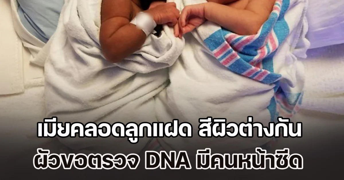 เป็นเรื่อง! เมียคลอดลูกแฝด สีผิวต่างกัน ชาวบ้านนินทายับ ผัวขอตรวจ DNA ผลออกมีคนหน้าซีด (ข่าว ตปท.)