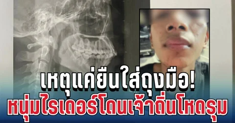 เจ้าถิ่นโหด! หนุ่มไรเดอร์โดนรุมเตะต่อย ร่างกายเจ็บสาหัส เหตุแค่ยืนใส่ถุงมือ