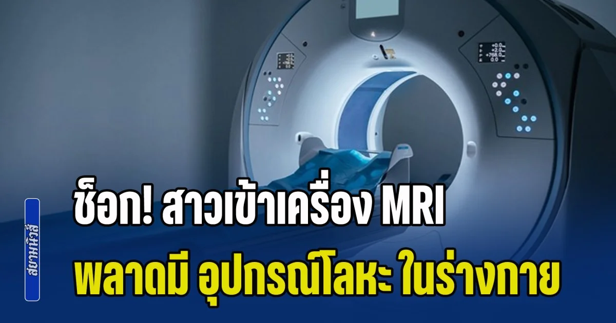 อุทาหรณ์ช็อก! สาวเข้าเครื่อง MRI พลาดมี อุปกรณ์โลหะ ในร่าง ถูกแรงดูดมหาศาล หวิดเสียชีวิต แต่ยังสาหัส (ข่าว ตปท.)