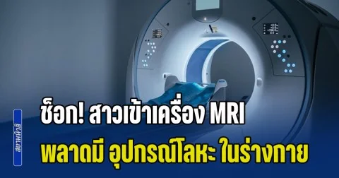 อุทาหรณ์ช็อก! สาวเข้าเครื่อง MRI พลาดมี อุปกรณ์โลหะ ในร่าง ถูกแรงดูดมหาศาล หวิดเสียชีวิต แต่ยังสาหัส (ข่าว ตปท.)