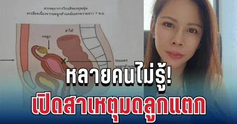 หลายคนไม่รู้! หมอของขวัญ เปิดสาเหตุมดลูกแตก ภาวะร้ายแรงที่อันตรายกว่าที่คิด