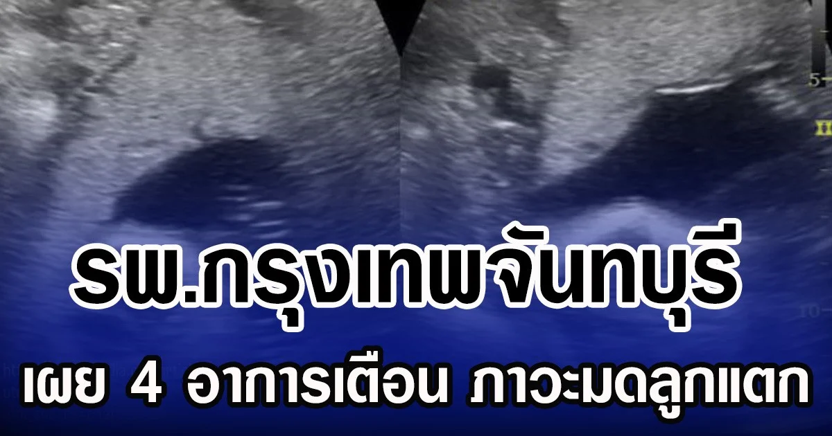 รพ.กรุงเทพจันทบุรี เผย 4 อาการเตือน ภาวะมดลูกแตก