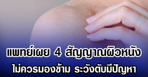 แพทย์เผย 4 สัญญาณผิวหนัง ไม่ควรมองข้าม ระวังตับมีปัญหา