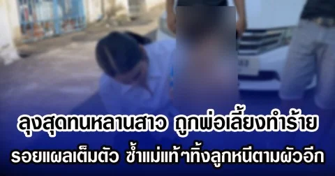 ลุงสุดทนหลานสาว ถูกพ่อเลี้ยงทำร้าย รอยแผลเต็มตัว ซ้ำแม่แท้ๆทิ้งลูกหนีตามผัวอีก