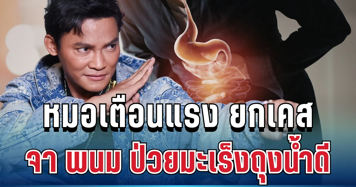 อย่ามองข้าม! หมอเตือนแล้ว ยกเคส จา พนม ป่วยมะเร็งถุงน้ำดี