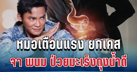 อย่ามองข้าม! หมอเตือนแล้ว ยกเคส จา พนม ป่วยมะเร็งถุงน้ำดี