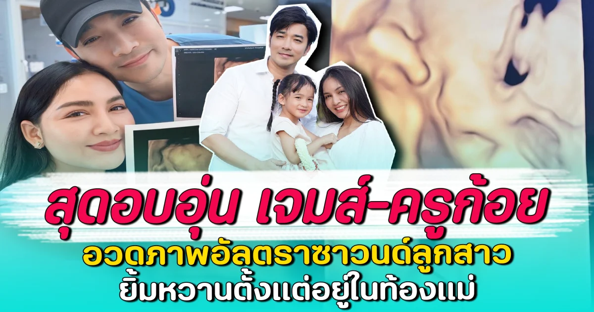สุดอบอุ่น เจมส์-ครูก้อย อวดภาพอัลตราซาวนด์ลูกสาว ยิ้มหวานตั้งแต่อยู่ในท้องแม่