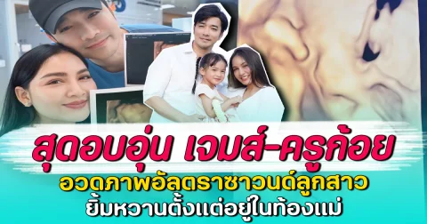 สุดอบอุ่น เจมส์-ครูก้อย อวดภาพอัลตราซาวนด์ลูกสาว ยิ้มหวานตั้งแต่อยู่ในท้องแม่