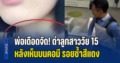 พ่อเดือดจัด! ด่าลูกสาววัย 15 หลังเห็นบนคอมี รอยช้ำสีแดง แต่เจอร่ายยาวโต้กลับ ถึงกับพูดไม่ออก (ข่าว ตปท.)