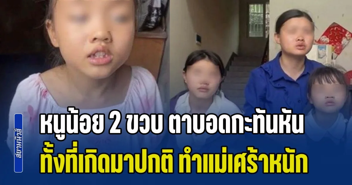 หนูน้อย 2 ขวบ ตาบอดถาวรกะทันหัน ทั้งที่เกิดมาปกติ คนเป็นแม่เศร้าหนัก หลังแพทย์เฉลยสาเหตุ ตัวเองคือส่วนหนึ่ง (ข่าว ตปท.)