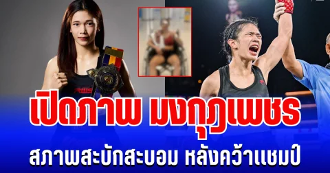สังเวียนมวยเดือด! เปิดภาพ มงกุฎเพชร นักชกสาว สภาพสะบักสะบอม หลังป้องเเชมป์สำเร็จ