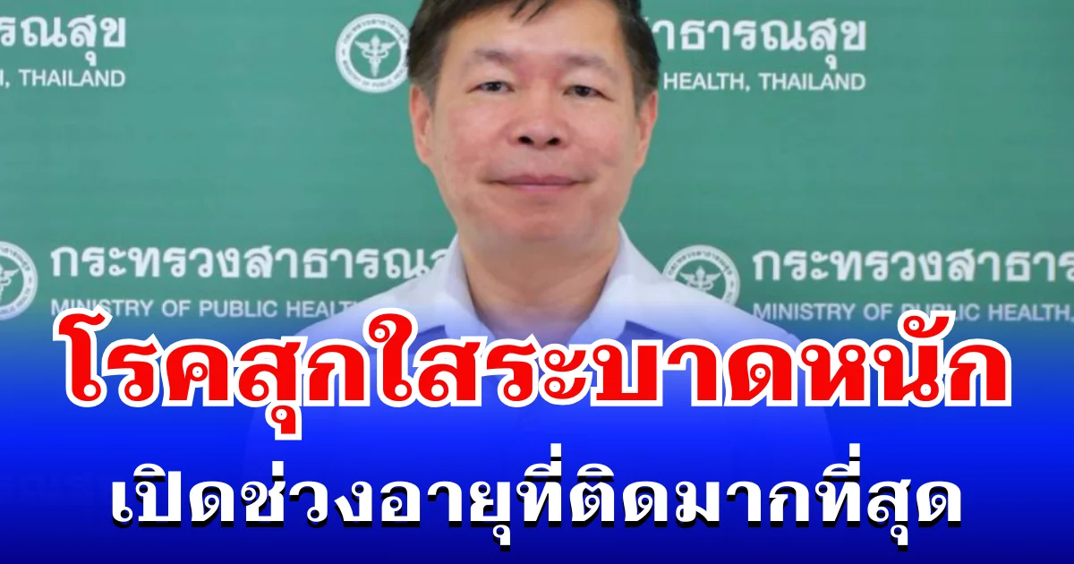 ยอดพุ่ง! โรคสุกใสระบาดหนัก เปิดช่วงอายุที่ติดมากที่สุด