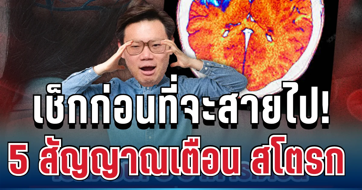 หลายคนแยกไม่ออก! หมอเผย 5 สัญญาณเตือน สโตรก ภัยใกล้ตัวเช็กก่อนจะสายไป