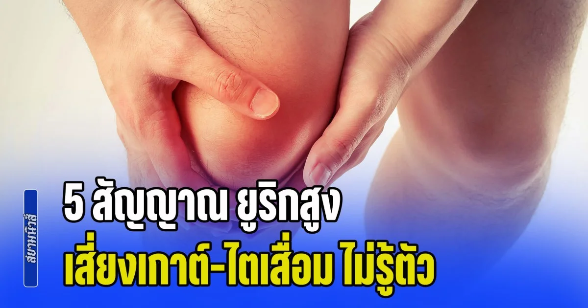 แพทย์เตือน 5 สัญญาณ ยูริกสูง เสี่ยงเกาต์-ไตเสื่อม แบบไม่รู้ตัว