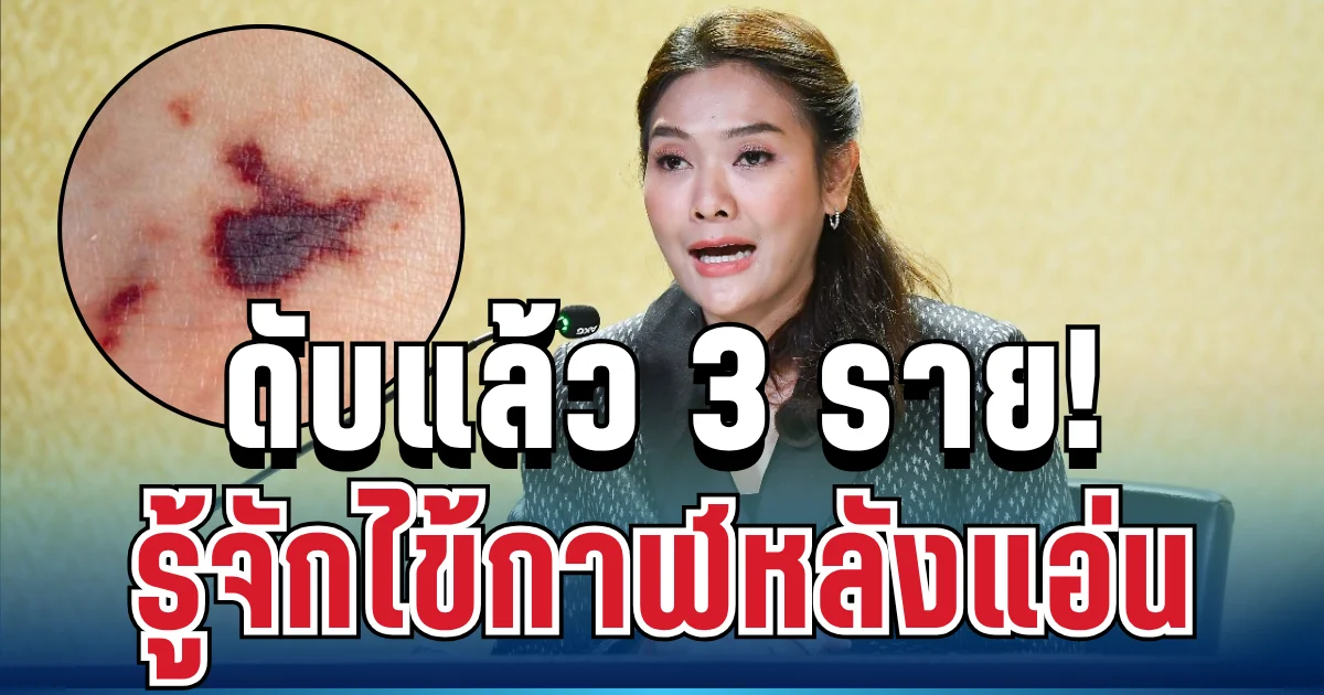 เตือนด่วน! ไทยเสียชีวิตแล้ว 3 ราย รู้จักไข้กาฬหลังแอ่น โรคร้ายแรงที่หลายคนยังไม่รู้