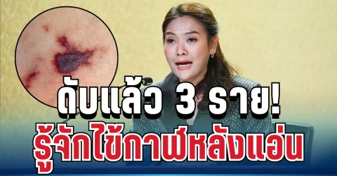 เตือนด่วน! ไทยเสียชีวิตแล้ว 3 ราย รู้จักไข้กาฬหลังแอ่น โรคร้ายแรงที่หลายคนยังไม่รู้