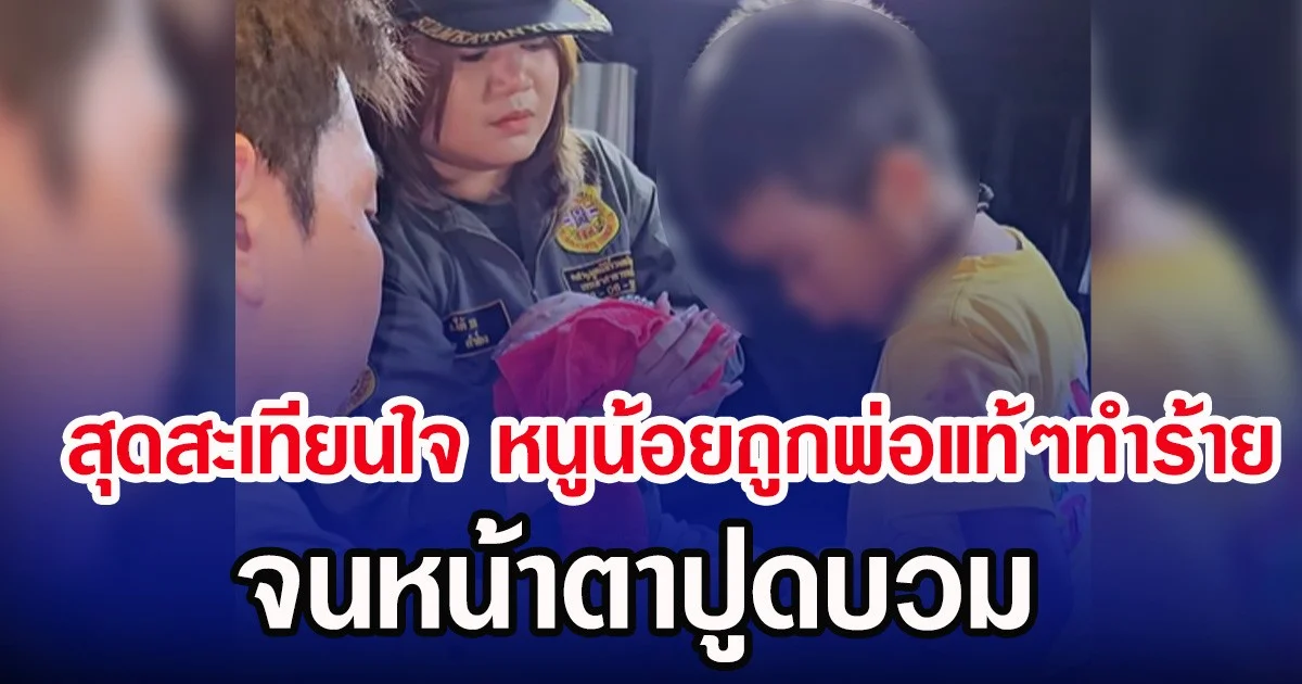 สุดสะเทียนใจ หนูน้อยถูกพ่อแท้ๆทำร้าย จนหน้าตาปูดบวม