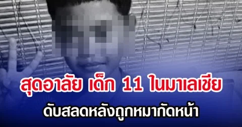 สุดอาลัย เด็ก 11 ในมาเลเชีย ดับสลดหลังถูกหมากัดหน้า (ตปท.)