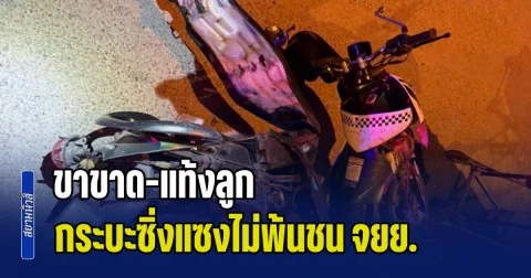 สุดสลด! สองสาวขี่ จยย. ถูกกระบะซิ่งสวนเลนแซงไม่พ้น พุ่งชนยับ คนซ้อนขาขาด-เสียลูกในครรภ์ ล่าสุดคนขับกระบะ มอบตัวแล้ว