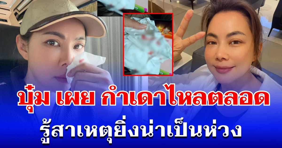 ทรมานมาก! บุ๋ม ปนัดดา เผย กำเดาไหลตลอดเวลา รู้สาเหตุยิ่งน่าเป็นห่วง