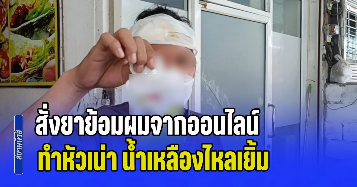 อุทาหรณ์! สั่งยาย้อมผมจากออนไลน์ ทำหัวเน่า น้ำเหลืองไหลเยิ้ม-หน้าตึง