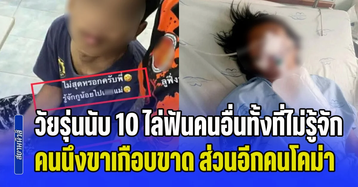 วัยรุ่นนับ 10 ไล่ฟันคนอื่นทั้งที่ไม่รู้จักกัน คนนึงขาเกือบขาด ส่วนอีกคนโคม่า ถูกรวบอยู่โรงพัก ยังลงสตอรี่ ทำอะไรผมไม่ได้ อ้างบ้านรวย มีเงิน