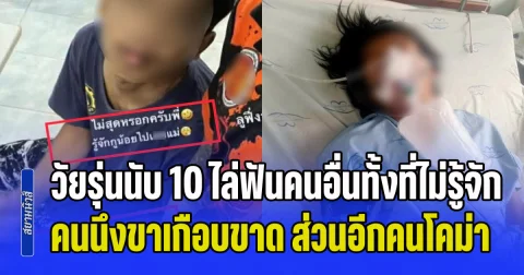 วัยรุ่นนับ 10 ไล่ฟันคนอื่นทั้งที่ไม่รู้จักกัน คนนึงขาเกือบขาด ส่วนอีกคนโคม่า ถูกรวบอยู่โรงพัก ยังลงสตอรี่ ทำอะไรผมไม่ได้ อ้างบ้านรวย มีเงิน