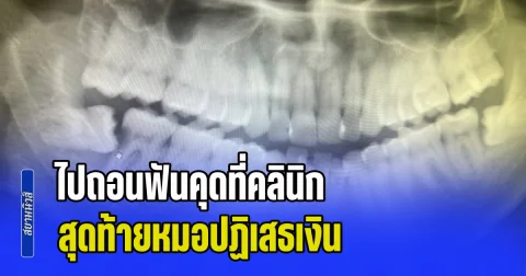 หญิงสุดงง! ไปถอนฟันคุดที่คลินิก ใช้เวลานานกว่า 3 ชม. สุดท้ายหมอปฏิเสธเงิน บอกศักดิ์ศรีไม่อนุญาต (ข่าว ตปท.)