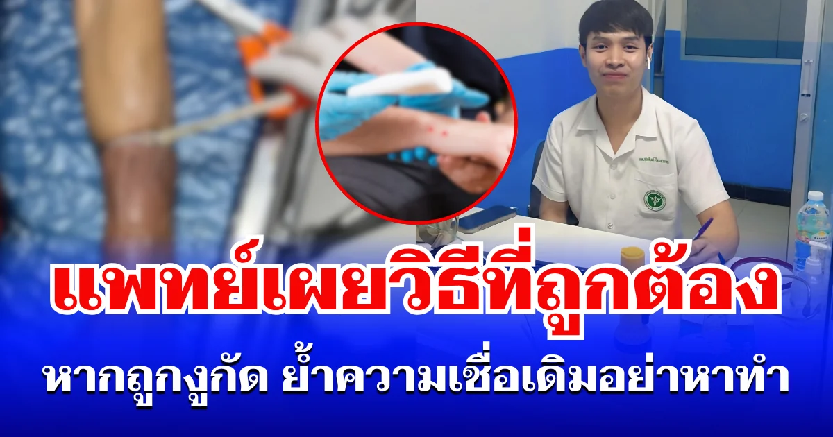 หลายคนเข้าใจผิด! แพทย์เผยวิธีที่ถูกต้อง หากถูกงูกัด ย้ำความเชื่อเดิมอย่าหาทำเด็ดขาด