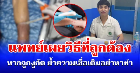 หลายคนเข้าใจผิด! แพทย์เผยวิธีที่ถูกต้อง หากถูกงูกัด ย้ำความเชื่อเดิมอย่าหาทำเด็ดขาด