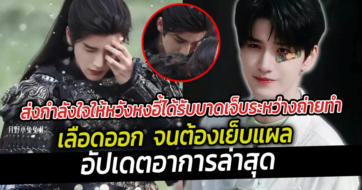 ส่งกำลังใจให้หวังหงอี้ได้รับบาดเจ็บระหว่างถ่ายทำ เลือดออก  จนต้องเย็บแผล อัปเดตอาการล่าสุด